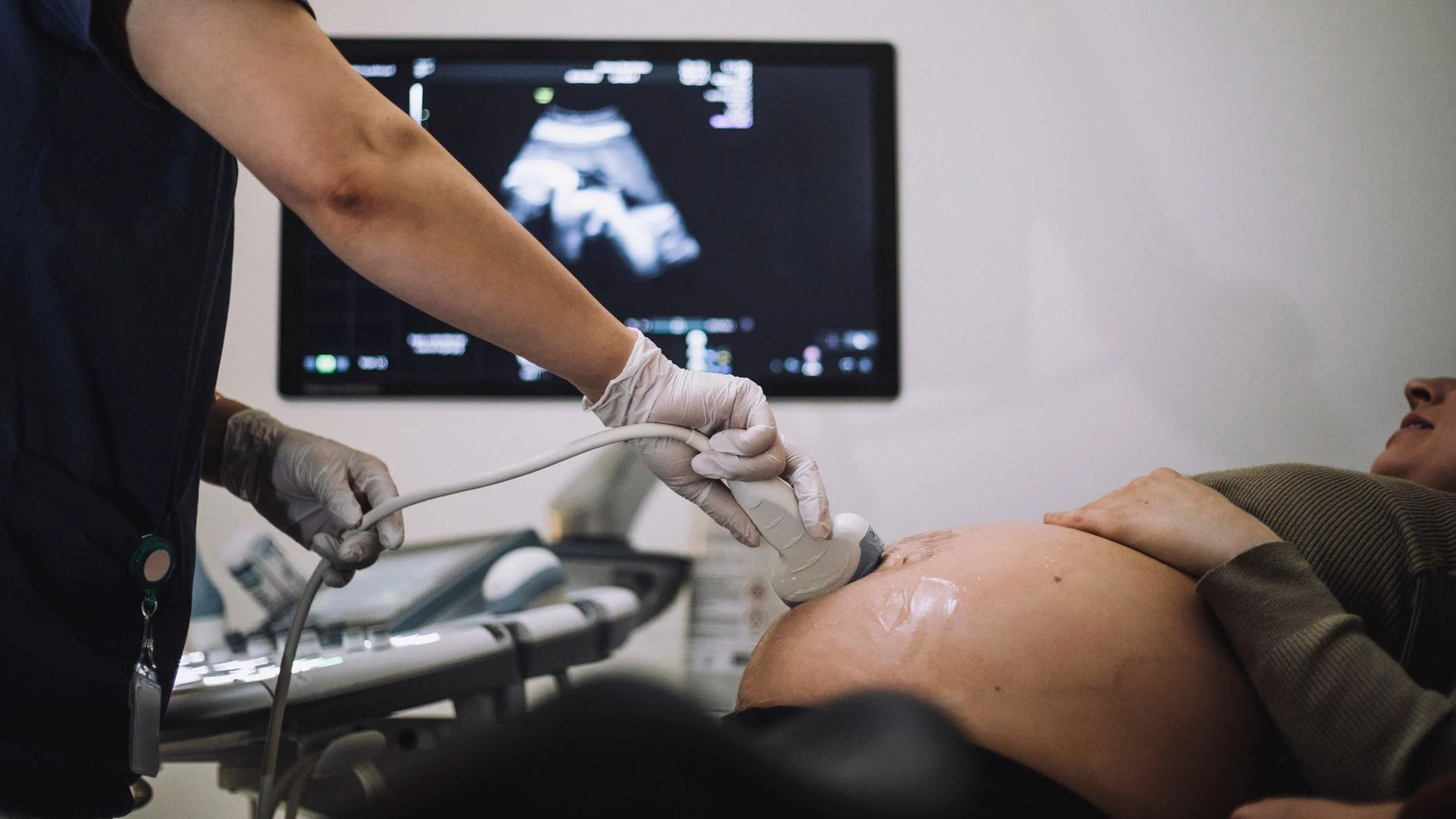 Mellizos con distintos padres: el raro fenómeno que sorprendió a la ciencia en Colombia